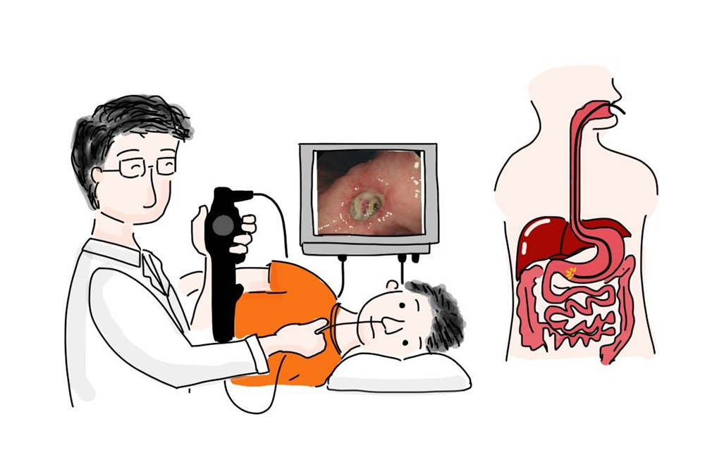 胃肠镜检查：有必要做吗？何时做？哪些结果需警惕？如何应对？